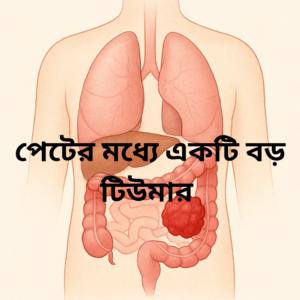 Read more about the article টিউমার কী? কারণ, লক্ষণ ও প্রতিকারের সহজ উপায় জানুন